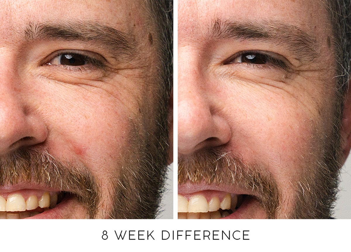 illuminate before and after - roddy